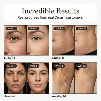 Cerasil® Scar Stick